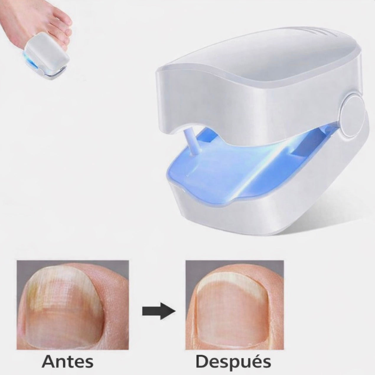 Dispositivo Láser para Hongos en las Uñas - additional image 2